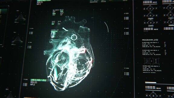 扫描的心人的心血管系统医疗技术