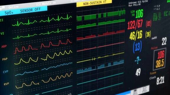 ICU监护仪显示患者病情、高烧、心律失常、病情