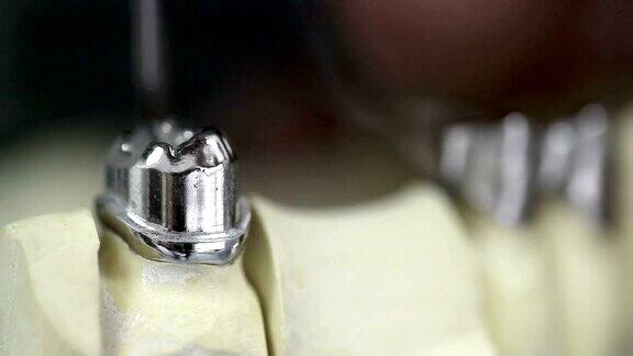 牙科诊所牙科工作者在实验室使用牙科铣床