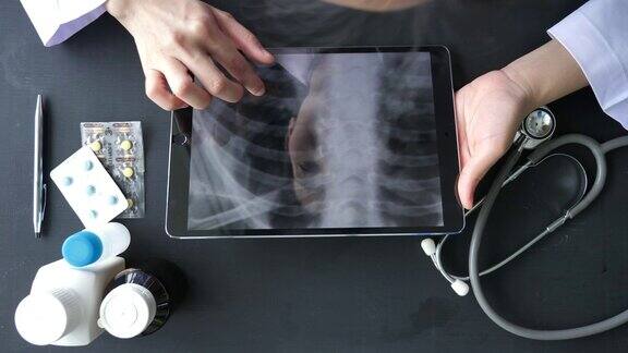 医生在平板电脑上分析x射线图像