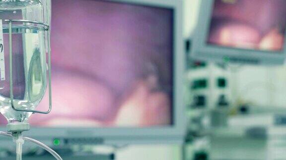 手术过程中滴管和内窥镜监视器