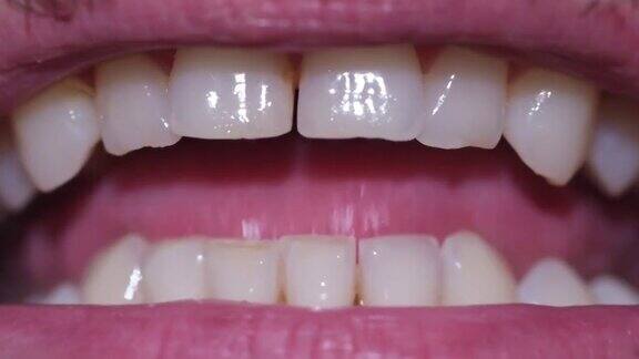 健康男人牙齿的宏观洁白的人类牙齿在微笑