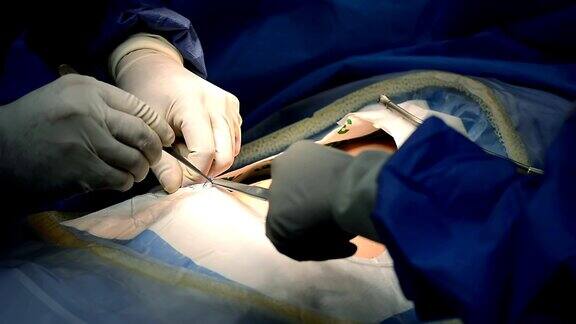对在手术室手术的外科医生、使用手术设备的外科医生团队和在医院急诊室进行手术的病人进行特写