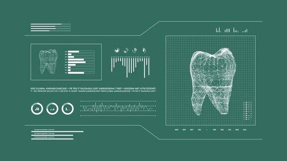 牙科软件或牙科数字化应用方案4k的3d动画