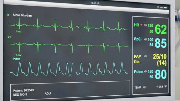 心电图病人心脏监护仪医院设备