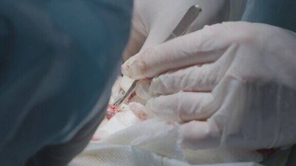 医生做手术切除阑尾行动外科医生在麻醉下给病人动手术肿瘤切除和器官手术