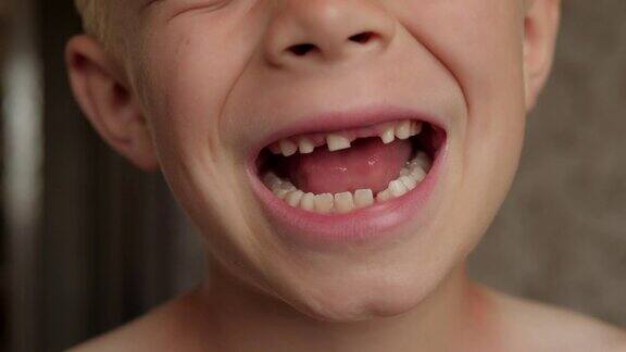 一个小男孩的特写镜头显示了他脱落的乳牙