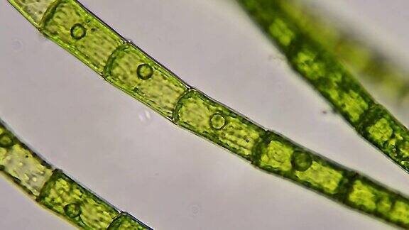 绿藻水生植物显微镜下特写