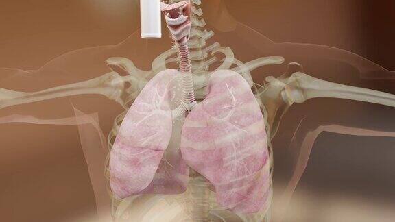 哮喘症状治疗细支气管哮喘吸入器哮喘发作3d渲染