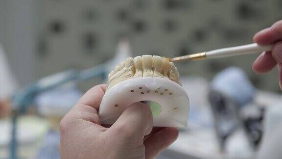牙科技师将牙桥冠放在石膏上