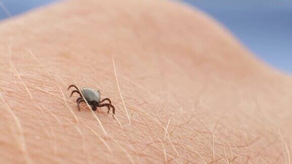 蜱虫在人类皮肤上勘探