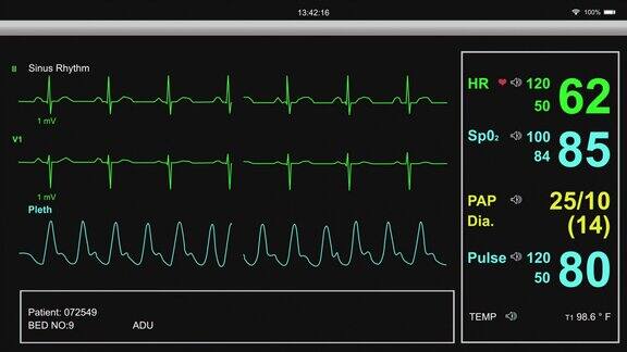 心电图病人心脏监护仪医院设备
