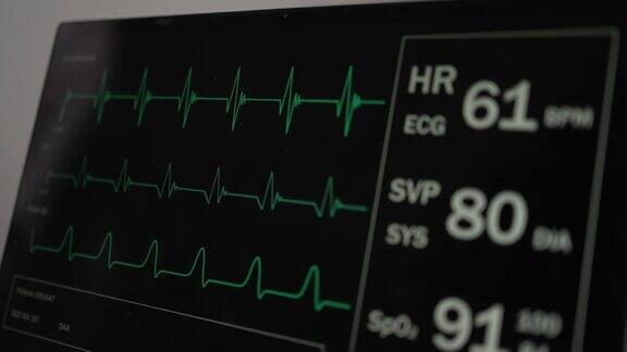 循环:患者监护仪显示生命体征、心电图、血氧饱和度、动脉血氧饱和度和呼吸医学检查4K视频片段动画心脏监测心电图仪