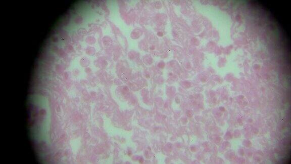 显微镜下的浆细胞