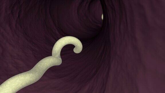 人体或动物肠道内寄生蠕虫的三维动画
