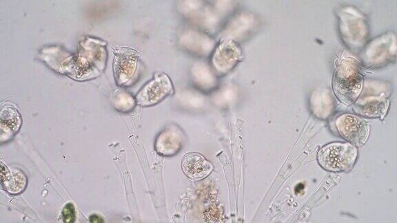 活体涡菌是显微镜下的原生动物属