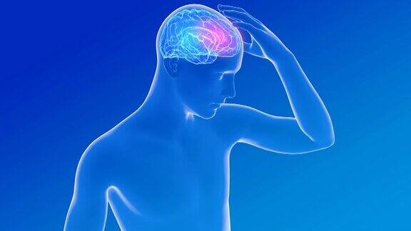 人体解剖三维动画显示头痛癫痫、头痛