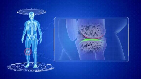 膝盖疼痛检查动画