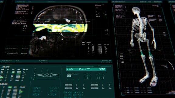 动画的用户界面HUD与身体分析和dna移动在黑暗的背景与谷物处理的未来概念