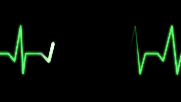 心电图记录心脏发出的电信号的心电图ECG或EKG概念:心脏跳动和停止强烈跳动或心脏骤停
